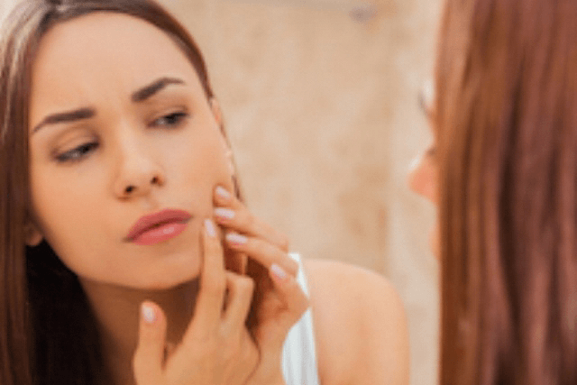 How to Prevent Acne with a Proper Skin Care Routine
